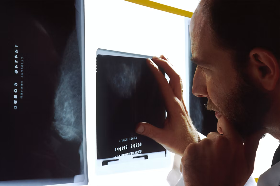 Radio-Diagnosis